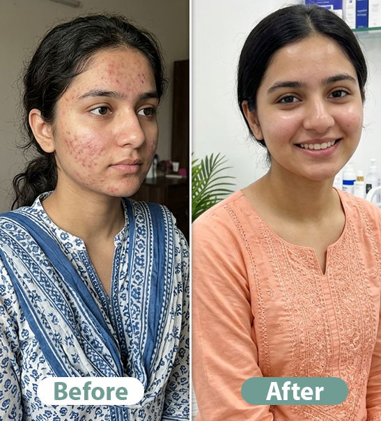 Before After Result