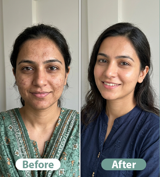 Before After Result