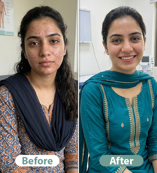 Before After Result